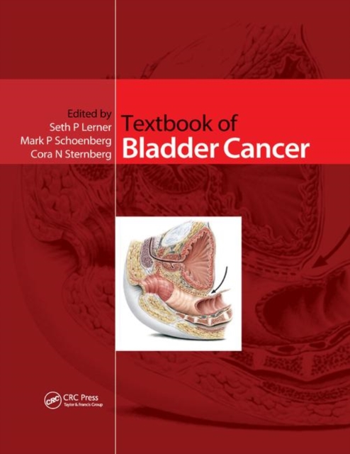Textbook of Bladder Cancer, Paperback / softback Book