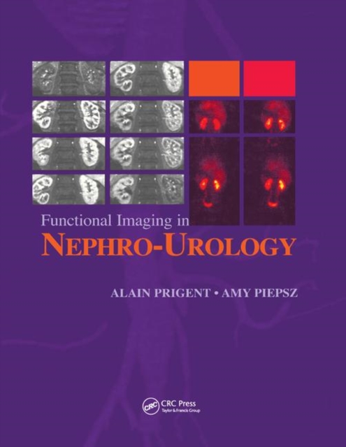 Functional Imaging in Nephro-Urology, Paperback / softback Book