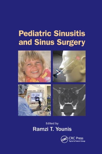 Pediatric Sinusitis and Sinus Surgery, Paperback / softback Book