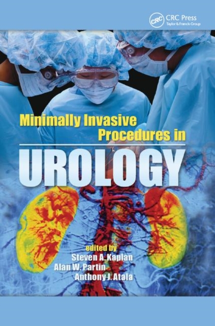 Minimally Invasive Procedures in Urology, Paperback / softback Book