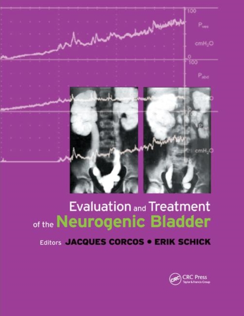 Evaluation and Treatment of the Neurogenic Bladder, Paperback / softback Book