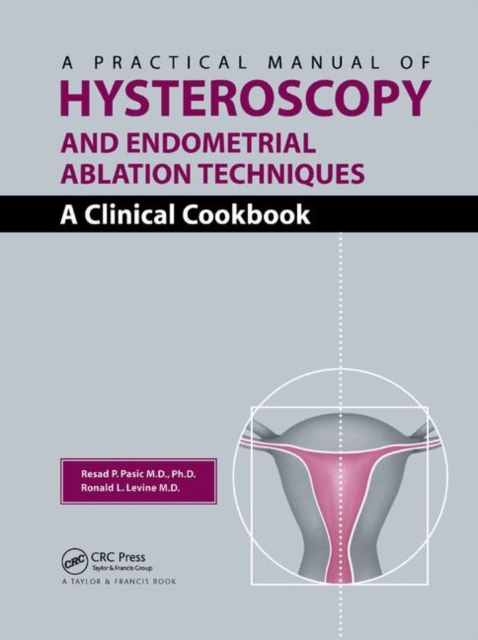 A Practical Manual of Hysteroscopy and Endometrial Ablation Techniques : A Clinical Cookbook, Paperback / softback Book