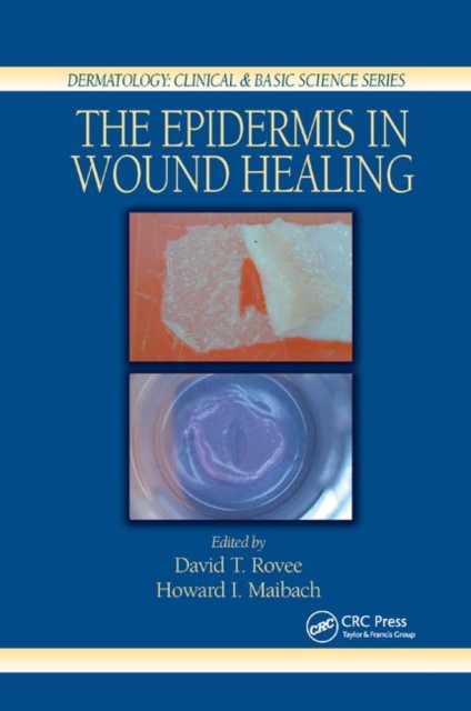 The Epidermis in Wound Healing, Paperback / softback Book
