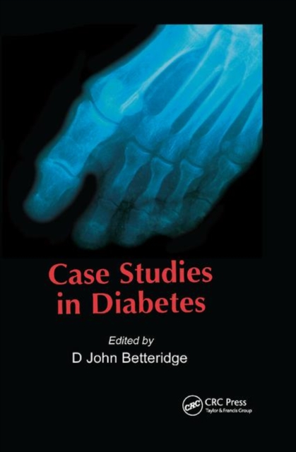 Case Studies in Diabetes, Paperback / softback Book