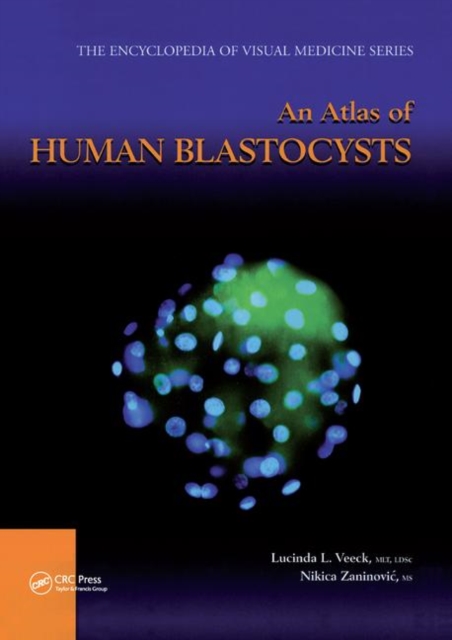 An Atlas of Human Blastocysts, Paperback / softback Book