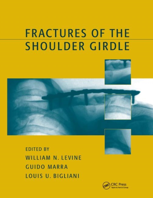 Fractures of the Shoulder Girdle, Paperback / softback Book