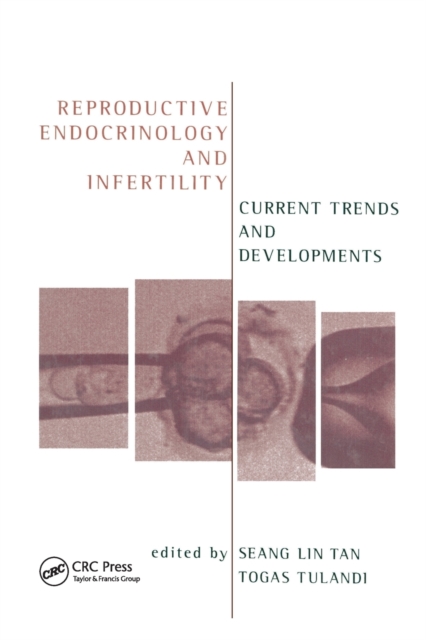Reproductive Endocrinology and Infertility : Current Trends and Developments, Paperback / softback Book