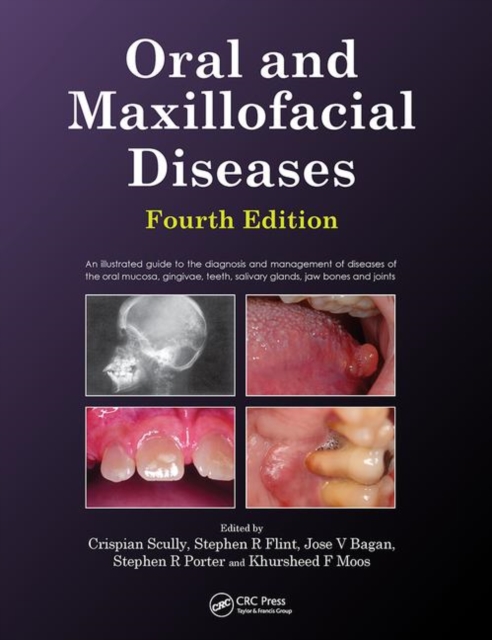 Oral and Maxillofacial Diseases, Fourth Edition, Paperback / softback Book