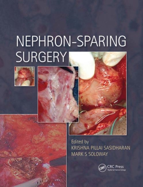 Nephron-Sparing Surgery, Paperback / softback Book
