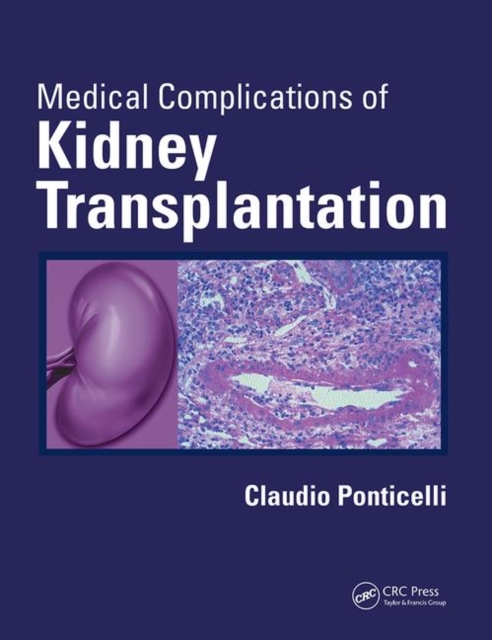 Medical Complications of Kidney Transplantation, Paperback / softback Book