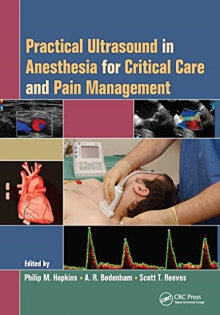 Practical Ultrasound in Anesthesia for Critical Care and Pain Management, Paperback / softback Book