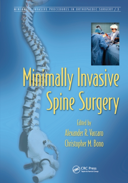 Minimally Invasive Spine Surgery, Paperback / softback Book