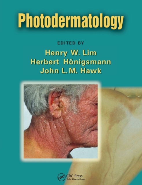 Photodermatology, Paperback / softback Book