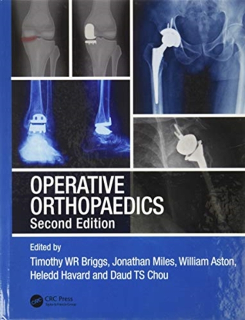 Operative Orthopaedics, Hardback Book