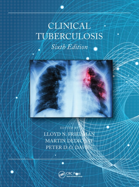 Clinical Tuberculosis, Paperback / softback Book