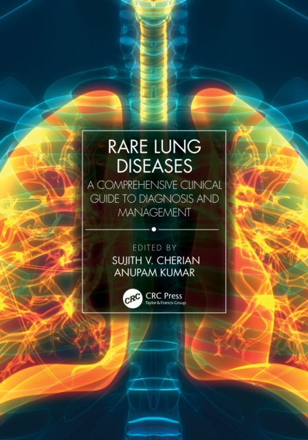 Rare Lung Diseases : A Comprehensive Clinical Guide to Diagnosis and Management, Paperback / softback Book