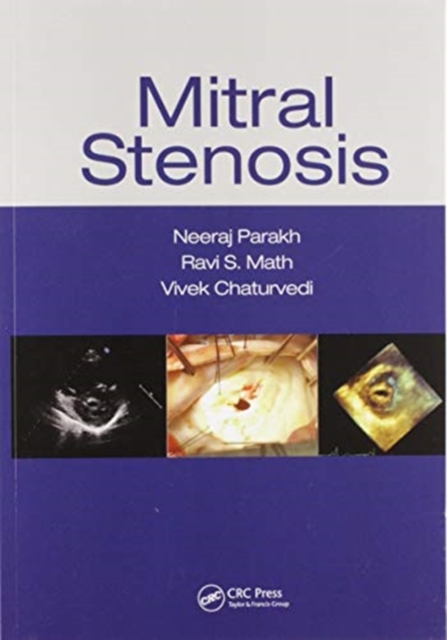 Mitral Stenosis, Paperback / softback Book