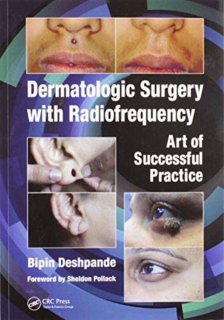 Dermatologic Surgery with Radiofrequency : Art of Successful Practice, Paperback / softback Book