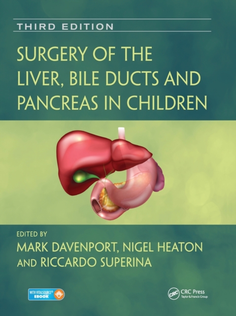 Surgery of the Liver, Bile Ducts and Pancreas in Children, Paperback / softback Book