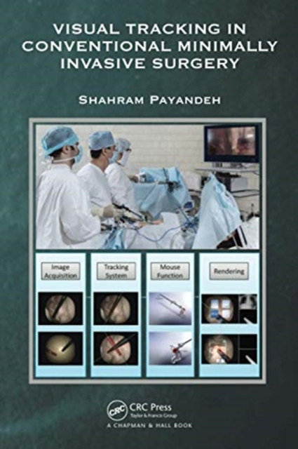 Visual Tracking in Conventional Minimally Invasive Surgery, Paperback / softback Book