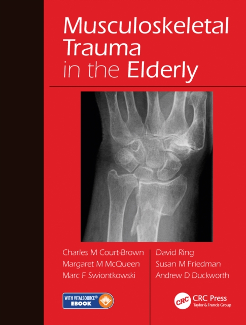 Musculoskeletal Trauma in the Elderly, Paperback / softback Book