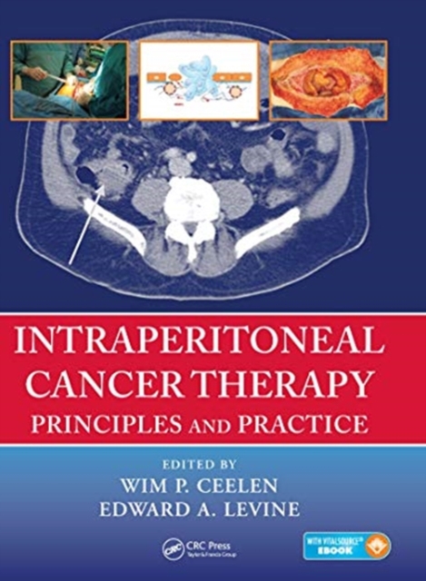 Intraperitoneal Cancer Therapy : Principles and Practice, Paperback / softback Book