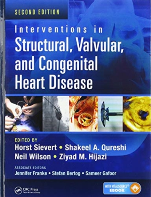 Interventions in Structural, Valvular and Congenital Heart Disease, Paperback / softback Book