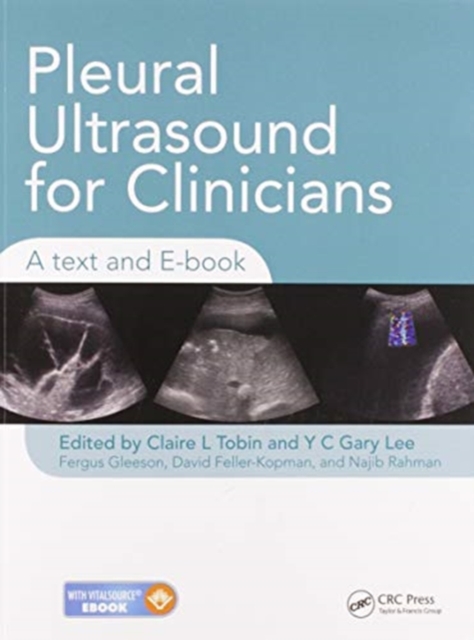 Pleural Ultrasound for Clinicians : A Text and E-book, Paperback / softback Book