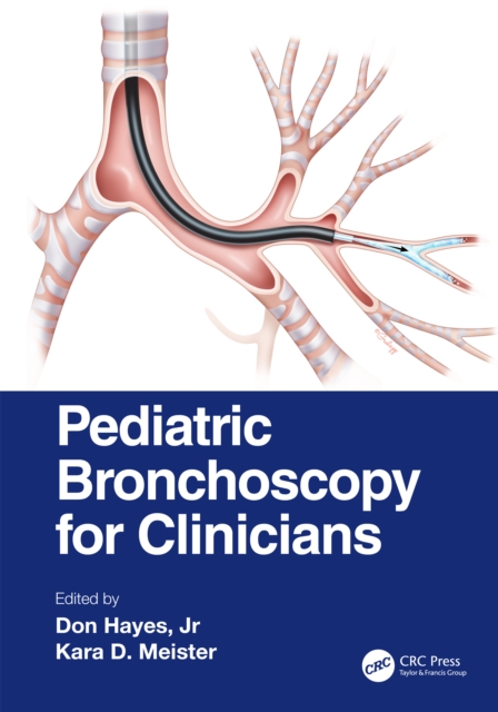 Pediatric Bronchoscopy for Clinicians, Hardback Book