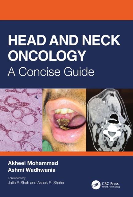 Head and Neck Oncology : A Concise Guide, Hardback Book