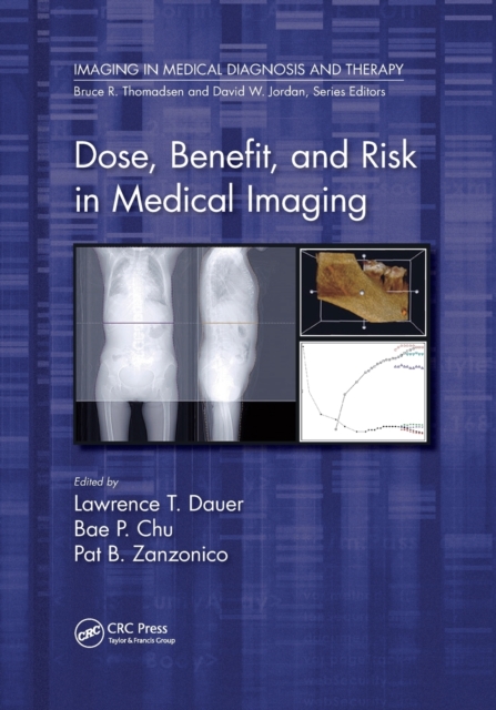 Dose, Benefit, and Risk in Medical Imaging, Paperback / softback Book