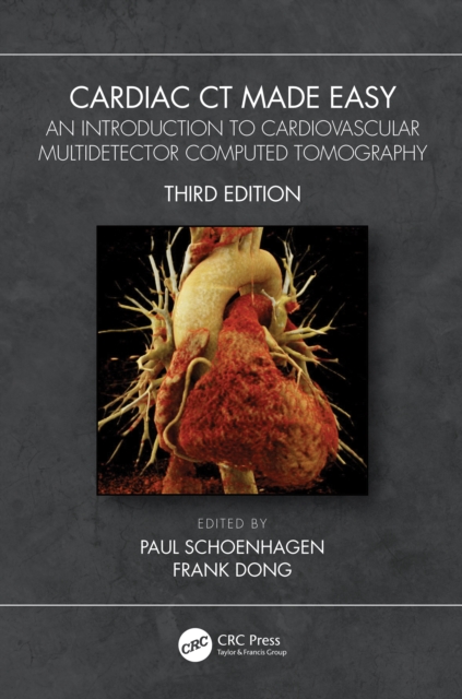 Cardiac CT Made Easy : An Introduction to Cardiovascular Multidetector Computed Tomography, Paperback / softback Book