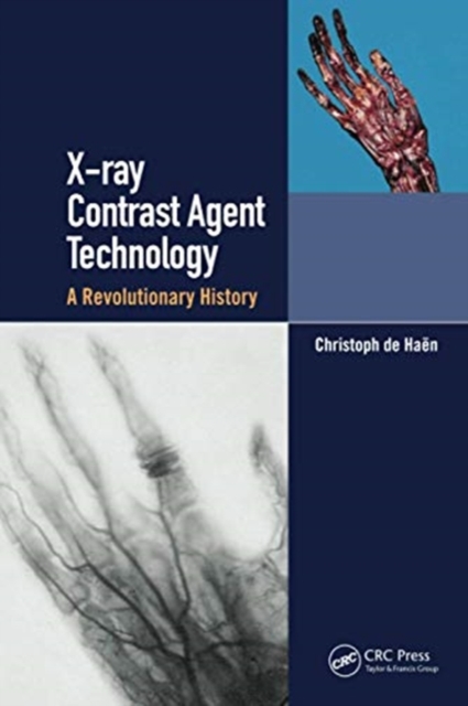 X-ray Contrast Agent Technology : A Revolutionary History, Paperback / softback Book