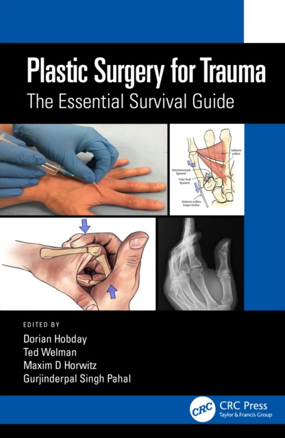 Plastic Surgery for Trauma : The Essential Survival Guide, Paperback / softback Book