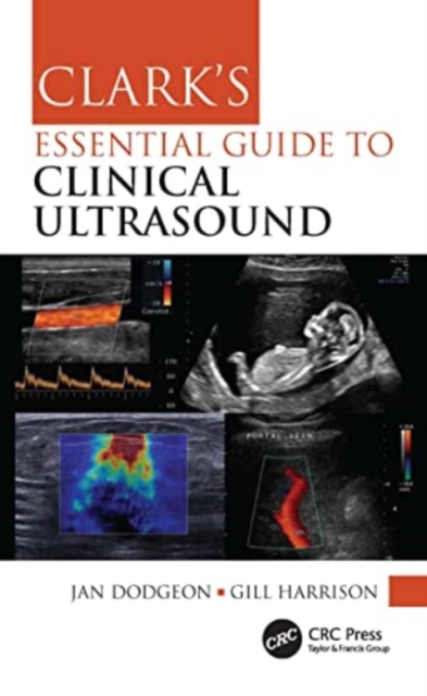 Clark's Essential Guide to Clinical Ultrasound, Paperback / softback Book