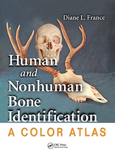 Human and Nonhuman Bone Identification : A Color Atlas, Paperback / softback Book