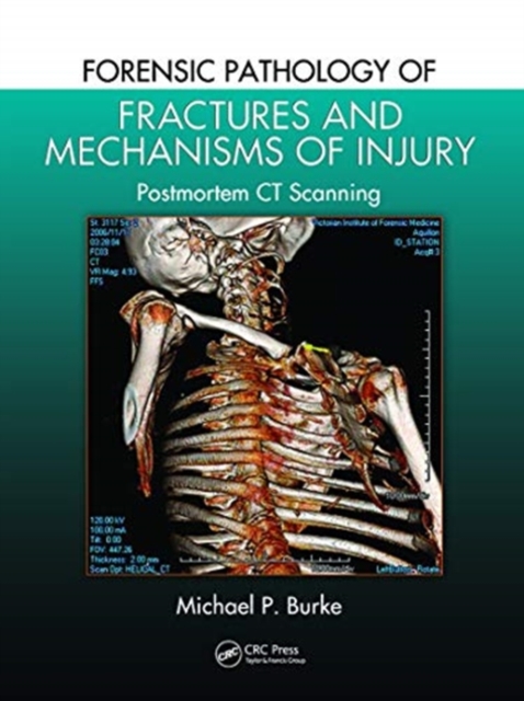 Forensic Pathology of Fractures and Mechanisms of Injury : Postmortem CT Scanning, Paperback / softback Book