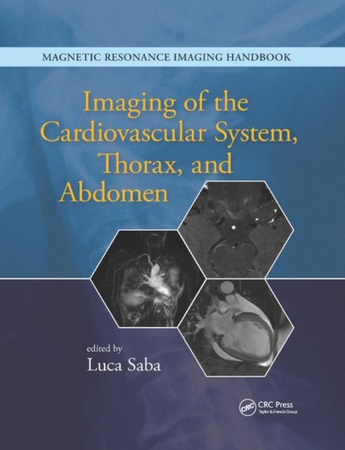Imaging of the Cardiovascular System, Thorax, and Abdomen, Paperback / softback Book