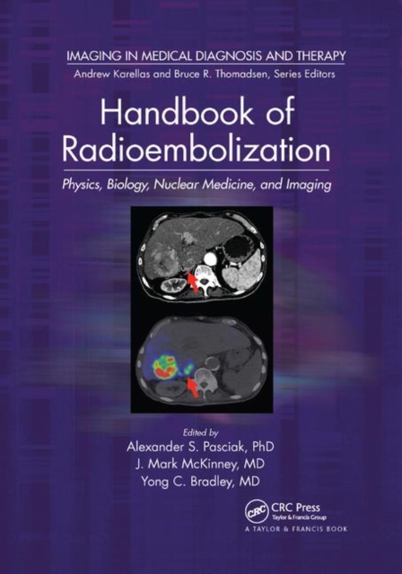 Handbook of Radioembolization : Physics, Biology, Nuclear Medicine, and Imaging, Paperback / softback Book
