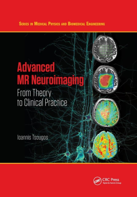 Advanced MR Neuroimaging : From Theory to Clinical Practice, Paperback / softback Book