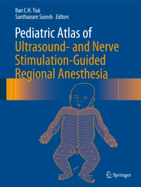 Pediatric Atlas of Ultrasound- and Nerve Stimulation-Guided Regional Anesthesia, Hardback Book