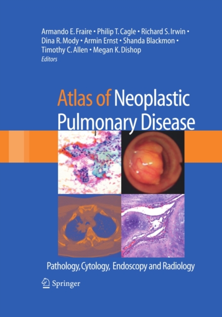 Atlas of Neoplastic Pulmonary Disease : Pathology, Cytology, Endoscopy and Radiology, PDF eBook
