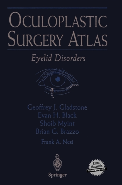Oculoplastic Surgery Atlas : Eyelid Disorders, Hardback Book