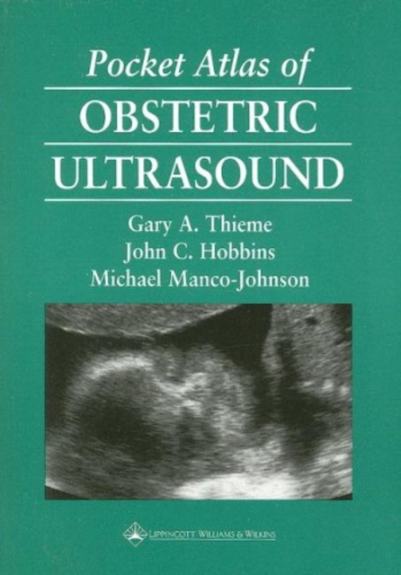 Pocket Atlas of Obstetric Ultrasound, Paperback / softback Book