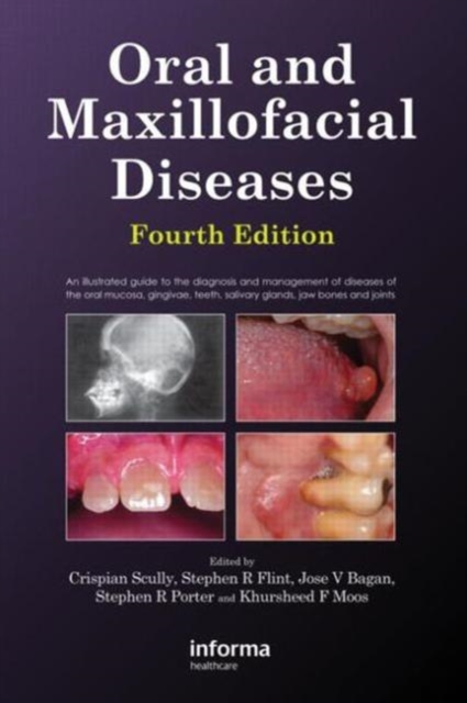 Oral and Maxillofacial Diseases, Fourth Edition, Hardback Book