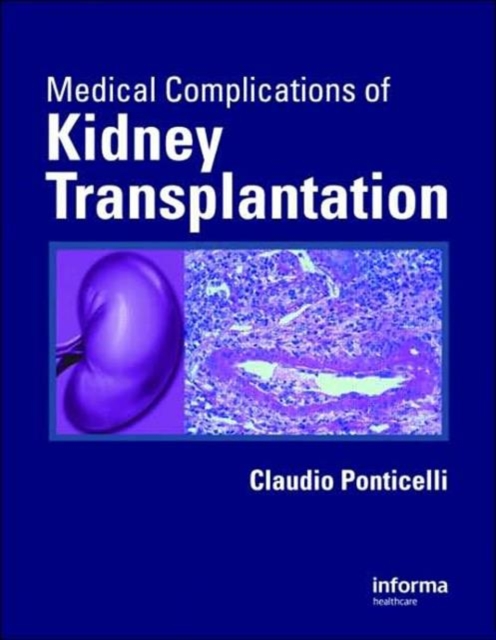 Medical Complications of Kidney Transplantation, Hardback Book