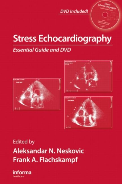 Stress Echocardiography : Essential Guide, Hardback Book