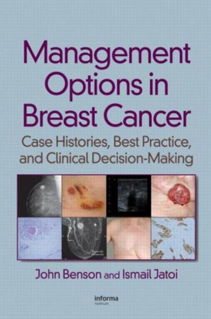 Management Options in Breast Cancer : Case Histories, Best Practice, and Clinical Decision-Making, Hardback Book