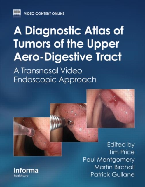 A Diagnostic Atlas of Tumors of the Upper Aero-Digestive Tract : A Transnasal Video Endoscopic Approach, Hardback Book