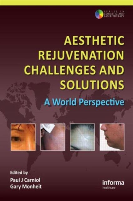 Aesthetic Rejuvenation Challenges and Solutions : A World Perspective, Hardback Book